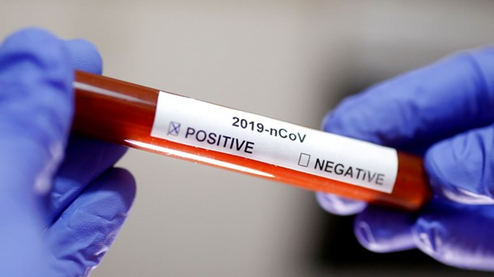 Ny coronavirus spredes rundt om i verden, og nu begynder det også at brænde på i forskningsverdenen. Både EU og private fonde laver hurtige uddelinger af penge til forskere, der skal bekæmpe sygdommen.<br>