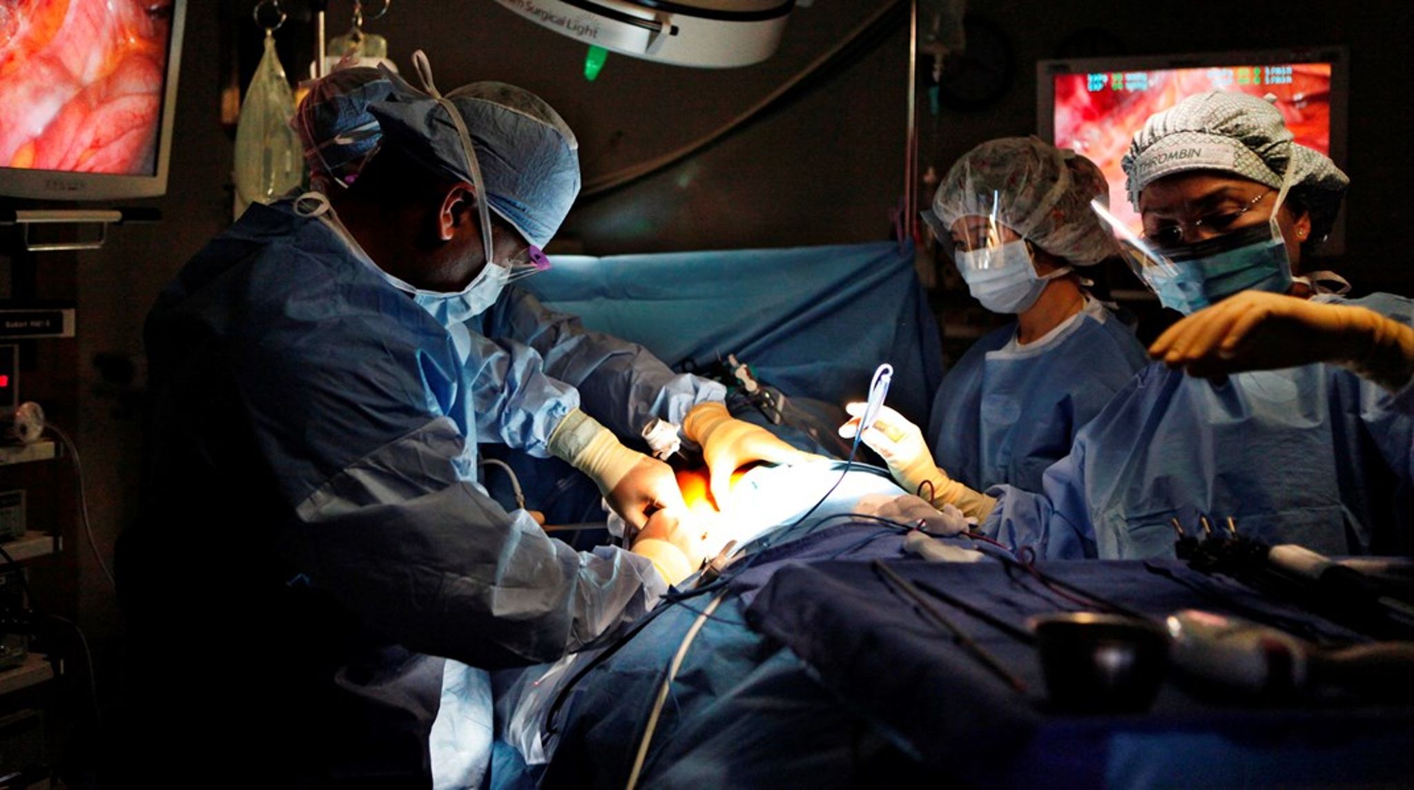 Der er i dag alt for lidt klar og lettilgængelig information om, hvad organdonation indebærer, både hvad angår de medicinske konsekvenser og de følelsesmæssige dilemmaer, mener Nyreforeningen.