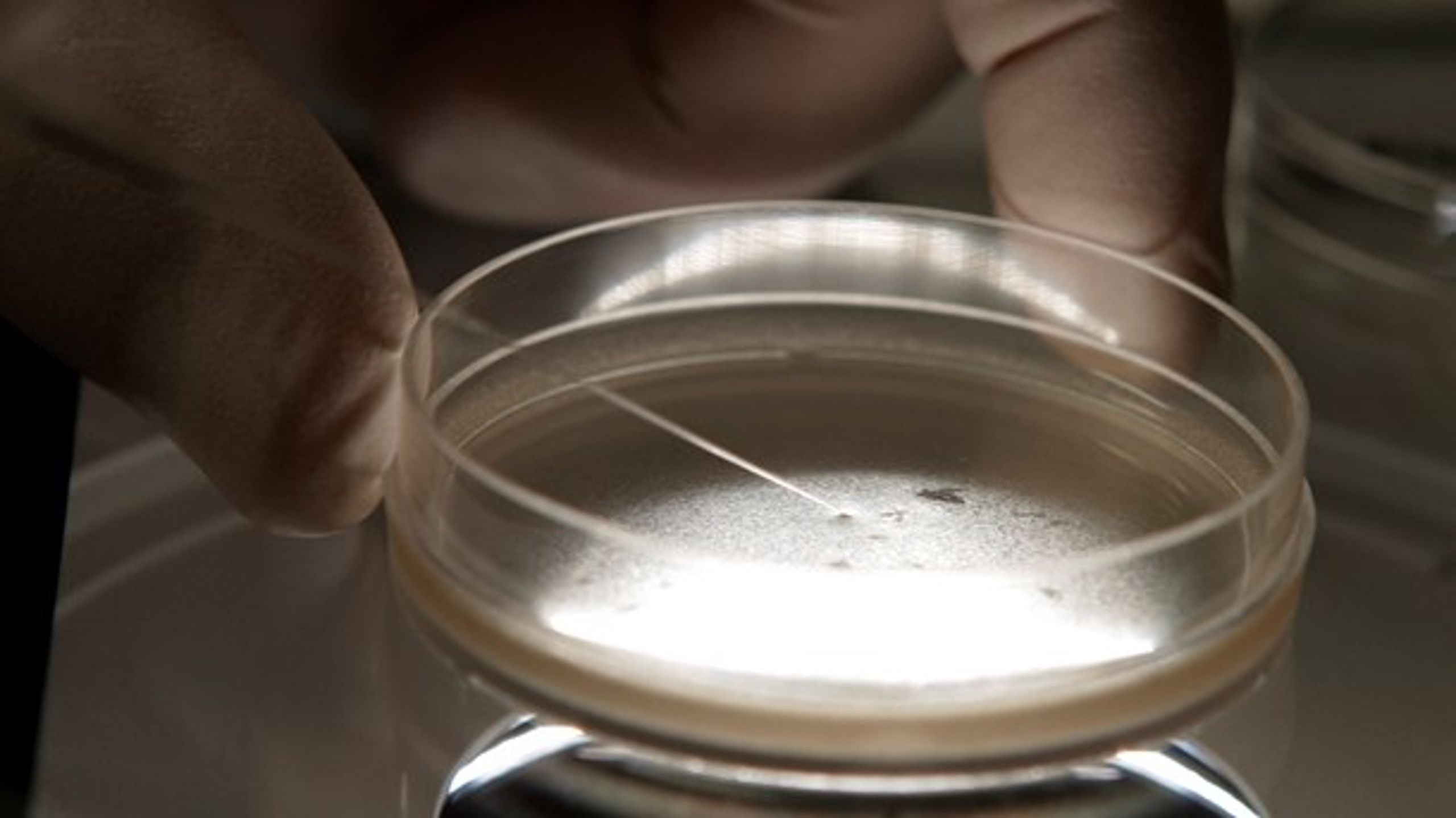 I Moustapha Kassems projekt vil stamceller både blive dyrket som på billedet – uden for kroppen – og indvendigt.&nbsp;