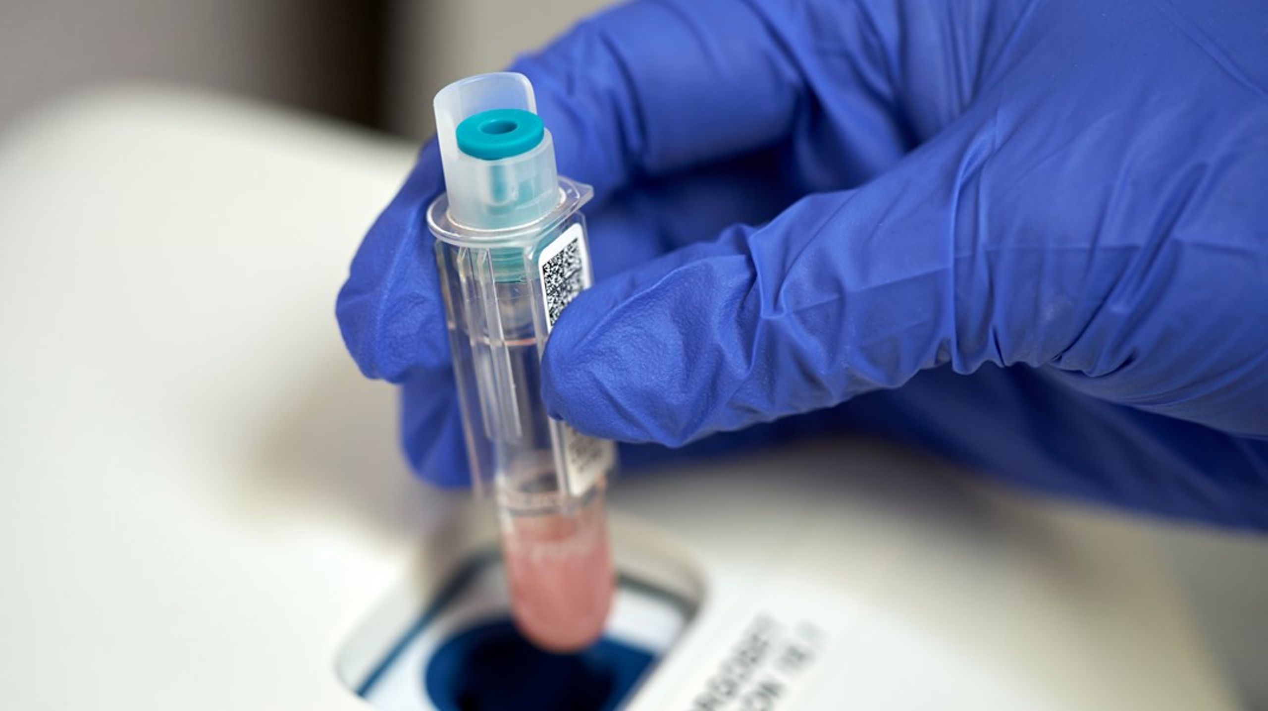 Et fælles laboratoriekort er ikke et luksusprojekt. Det er basal infrastruktur for et moderne sundhedsvæsen, skriver Nicolai J. Wewer Albrechtsen,&nbsp;Shirwa&nbsp;Adan og Ditte Hermann.