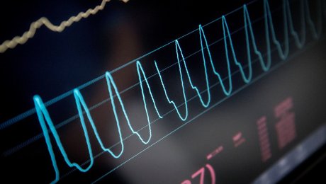 Ny doktors forskning kan føre til hurtigere opdagelse af nyresygdom 