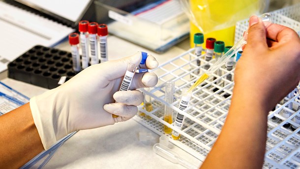 Lif: Offentlig forskning skal understøtte privat forskning