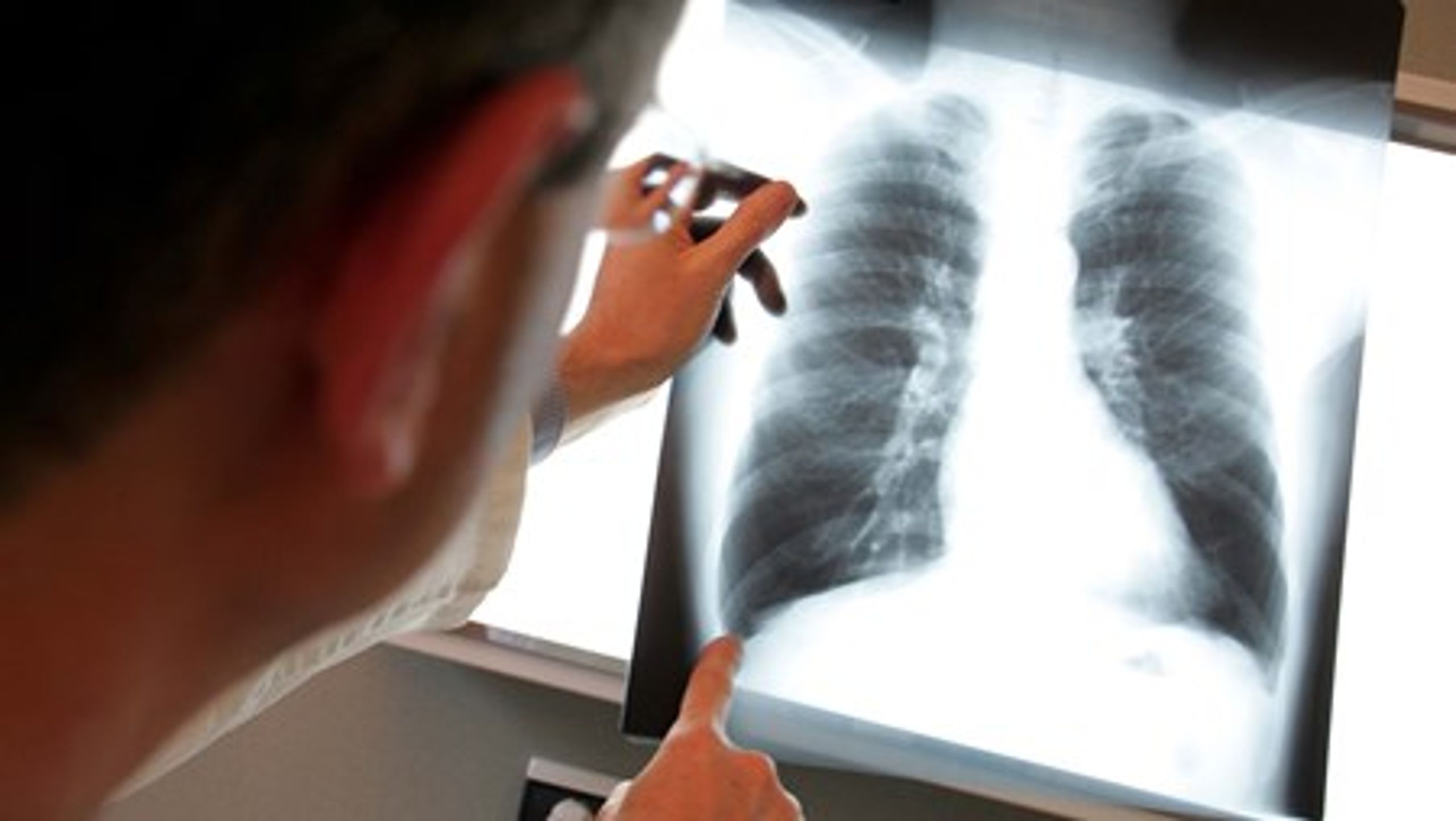 Nyeste tal fra Telecare Nord viser, at der er økonomiske fordele ved at behandle lungepatienter med telemedicin.