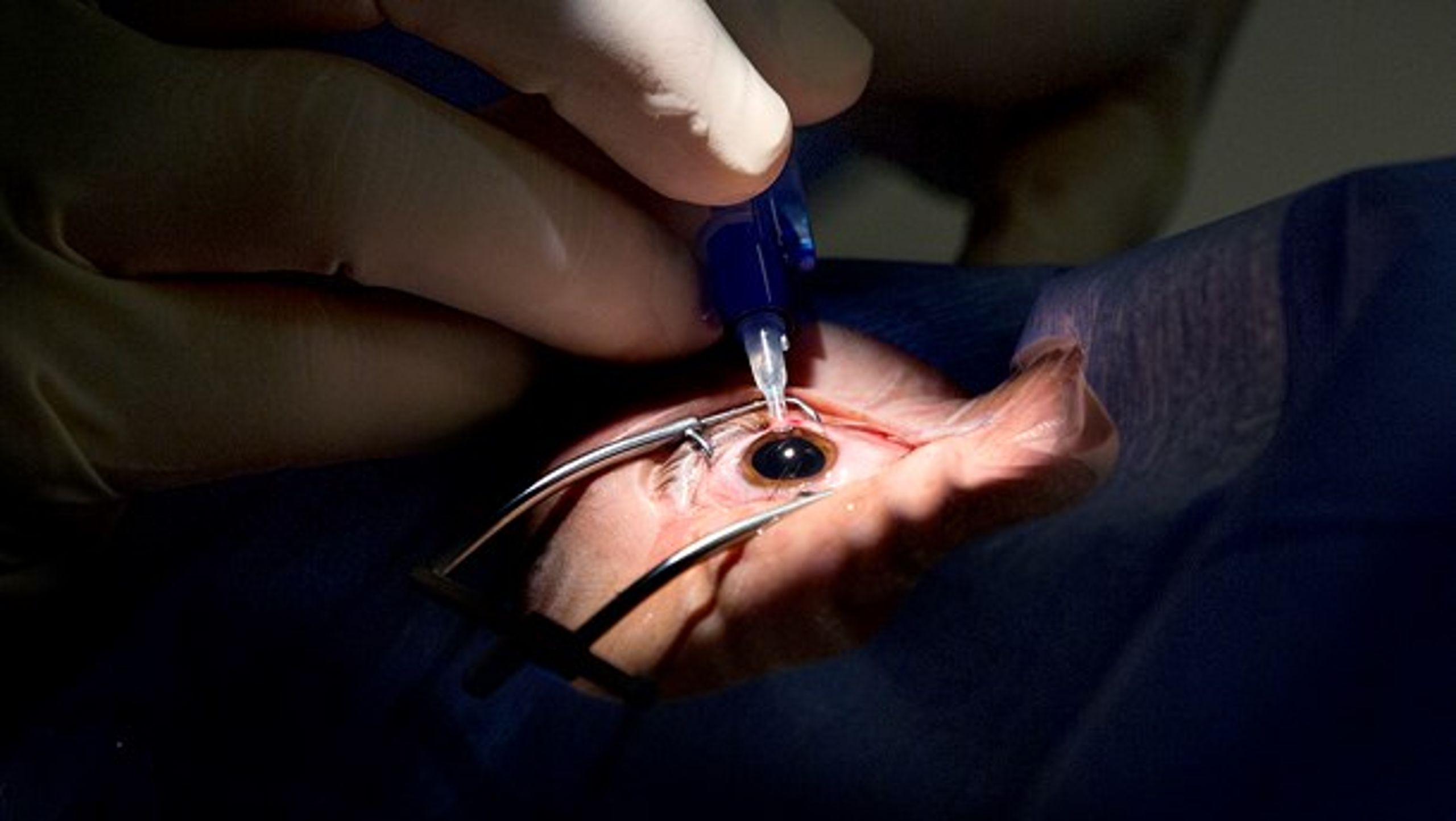 Velux Fonden har foretaget sin næststørste bevilling til øjenforskning nogensinde.