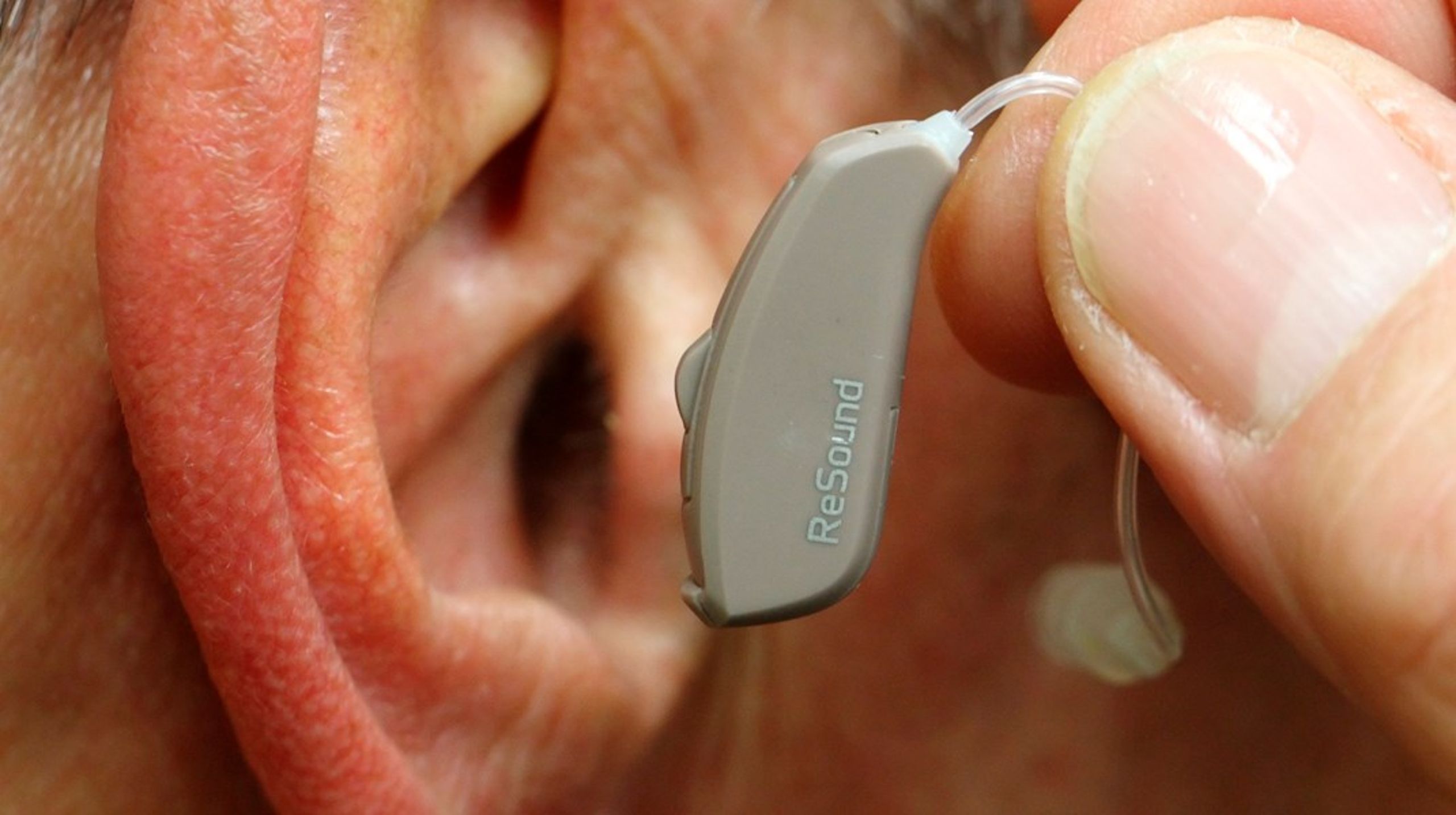 De private audiologer&nbsp;kan hjælpe med de for&nbsp;lange ventetider på behandling af høretab, skriver Peter Andreasen.