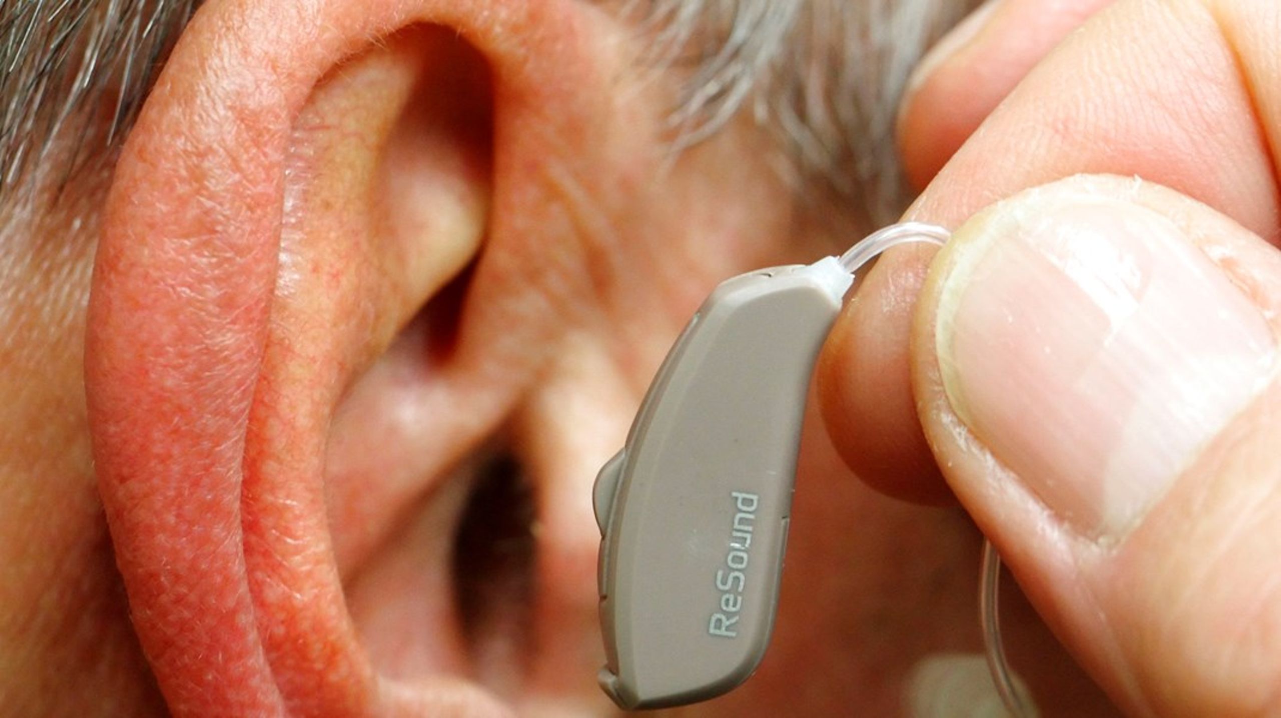 80 procent af alle over 80 år lider af høretab, og netop den gruppe forventes at vokse med 150.000 frem mod 2028, skriver Arbejdsgruppe for Fremtidens Hørerehabilitering.
