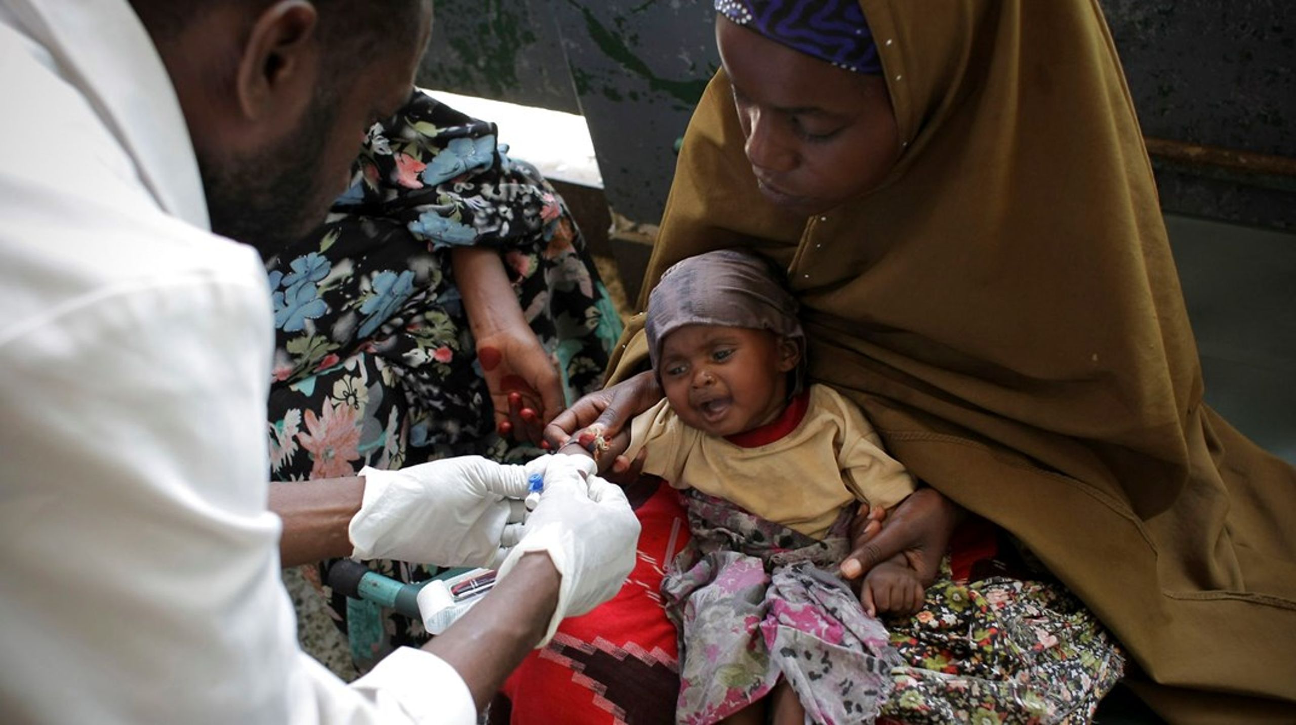 I nogle af de hårdest ramte områder på Afrikas Horn er tre gange så mange børn allerede døde på grund af underernæring i år sammenlignet med hele sidste år, skriver Susanne Dahl. Arkivfoto.