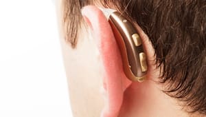 Meget dyrt at spare på høreapparater