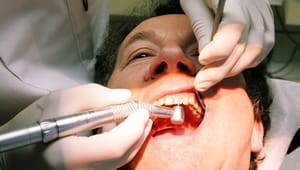 Fornyet strid om brugerbetaling på tandpleje
