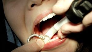 Dansk Tandplejerforening: Børns tænder sladrer om mere end mundpleje