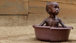 Unicef-udsendt: Sultende børn har ikke brug for mine følelser