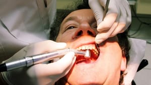 Tandlæge: Magtkamp om tandplejen går ud over danskernes tænder