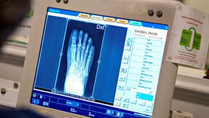 Formand: Private kiropraktorer kan hjælpe med nedbringe ventelister på røntgenbilleder