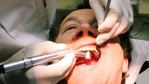 SF vil give de fattige gratis tandlæge