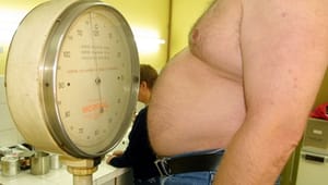 Mangel på fedmetiltag til de svage grupper