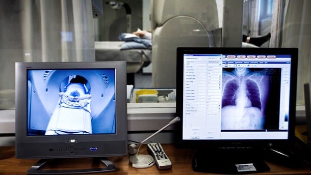 Fagfolk: Screening for lungekræft kan blive en lappeløsning