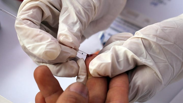 Aids-Fondet og Institut for Menneskerettigheder: Danmark skal gå forrest med støtte til en hiv-vaccine 